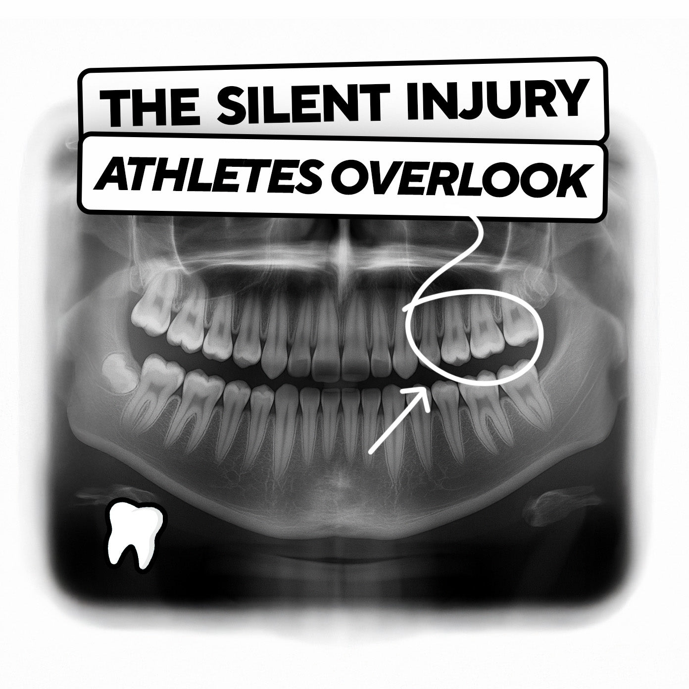 Athlete with xray showing dental issues